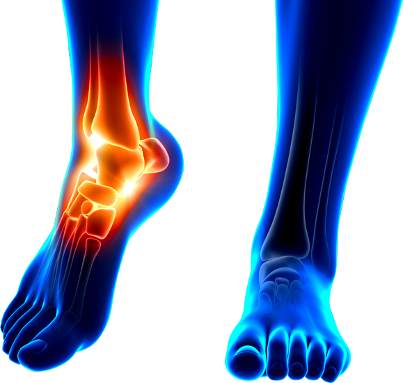 Image of a painful ankle